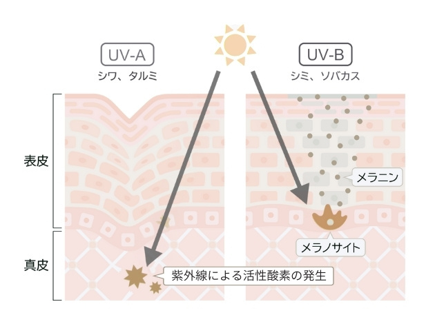 紫外線ダメージのイメージ